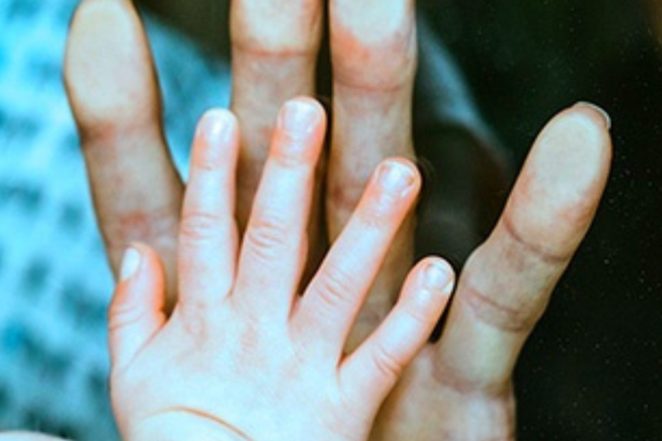 Life Cover vs Income Protection: What Protection Do You Really Need?